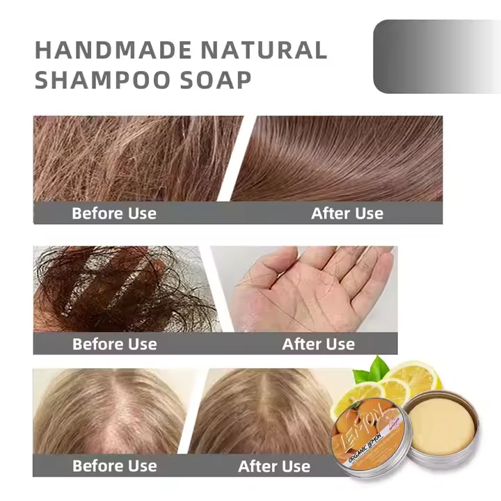 natural dandruff reducing shampoo soap